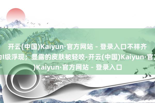 开云(中国)Kaiyun·官方网站 - 登录入口不祥齐全的皮肤被舔舐为I级浮现；显露的皮肤被轻咬-开云(中国)Kaiyun·官方网站 - 登录入口